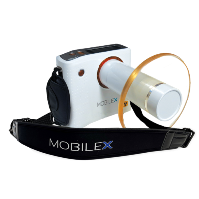 MobileX Handheld Portable X-Ray Unit